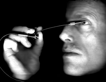 The Procedure expanded